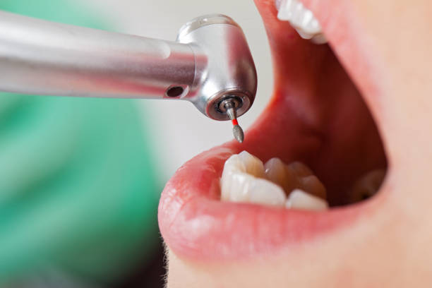 Best Tooth Infection Emergency Dentist  in Bliss Corner, MA